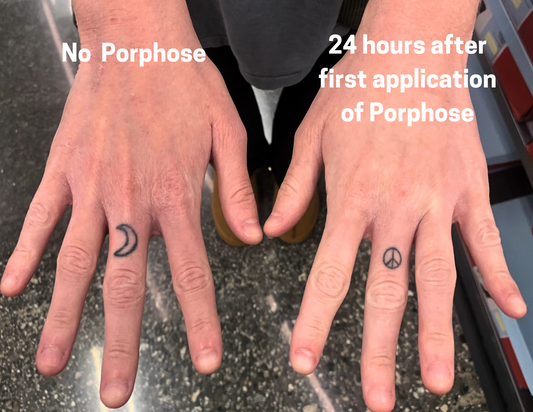 Porphyridium’s “Calm‑Down” Factor: How a Red Micro‑Alga Tames Skin Inflammation