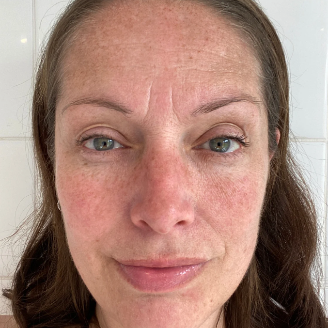 Porphyridium cruentum and Hyperpigmentation: What the Research Shows